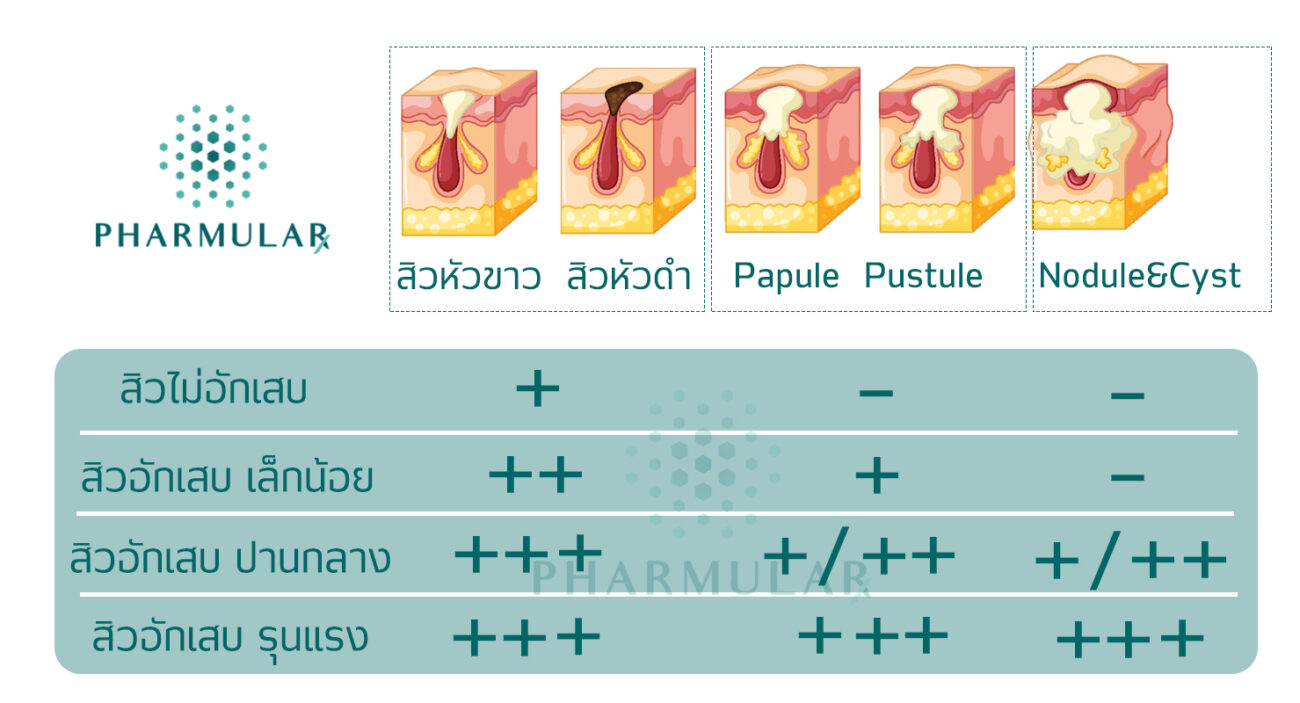 ประเภทสิว