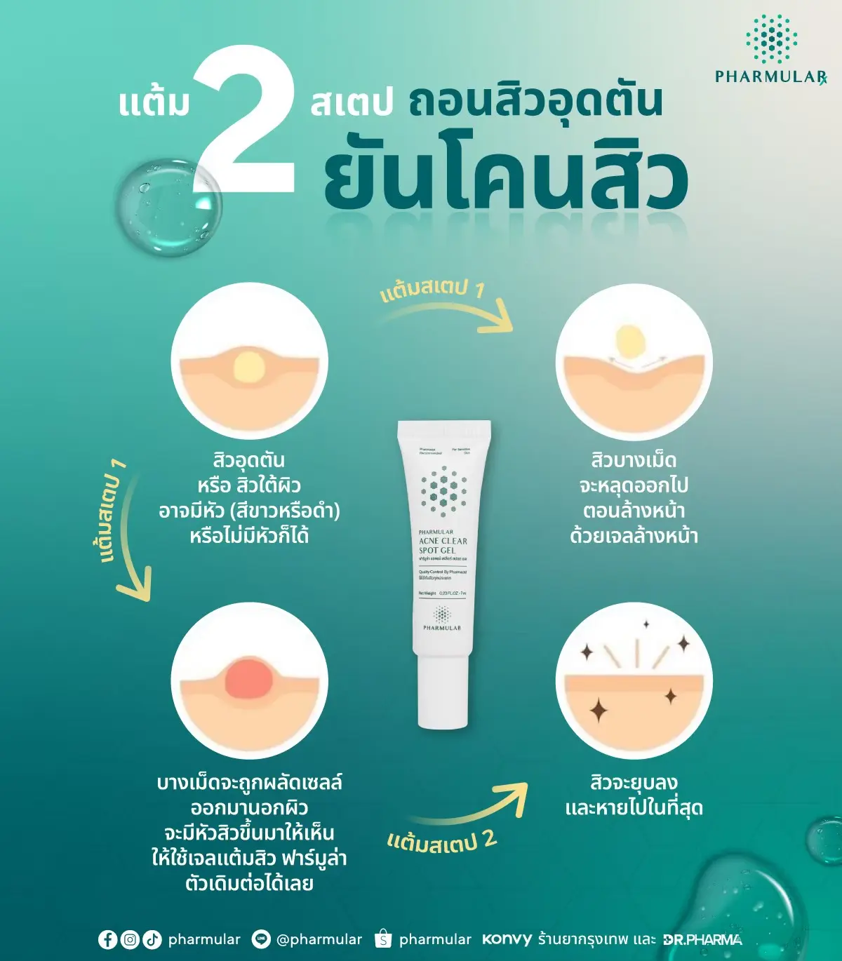 เจลแต้มสิว ลดสิวอุดตัน