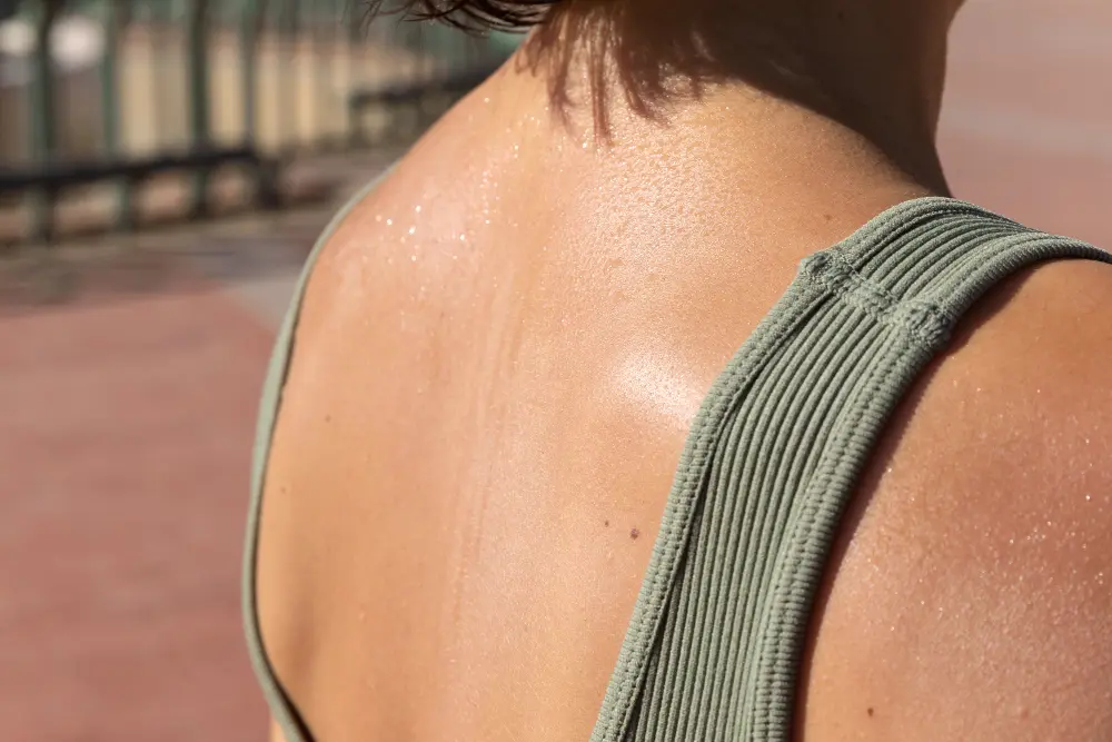 สิวยีสต์ เกิดจาก