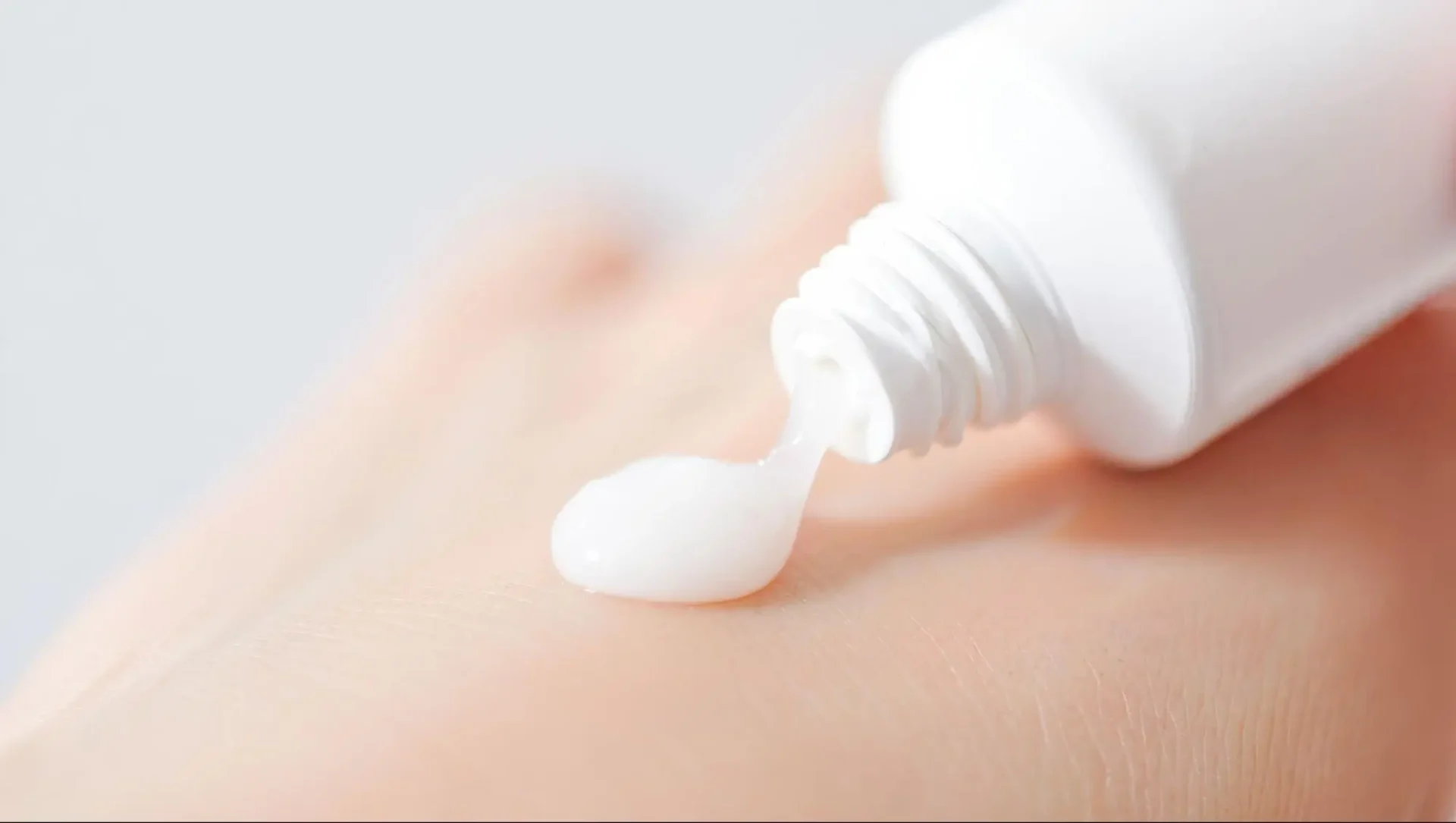 สิวยีสต์ รักษาเอง